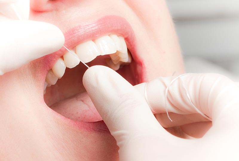 Professionelle Zahnreinigung ist für den Erhalt der Zähne eine wichtige Massnahme